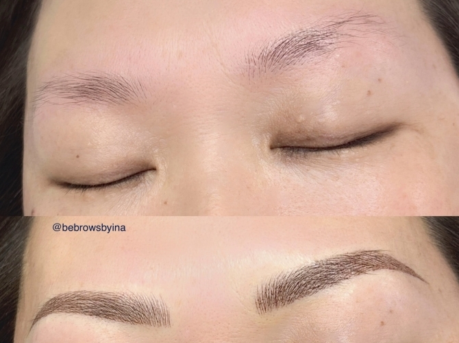 Before & After 