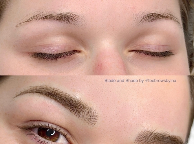 Before & After 