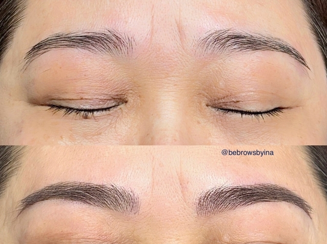 Before & After 