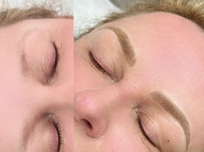 Before & After 