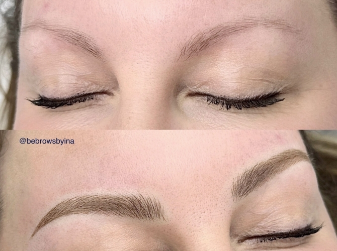 Before & After 