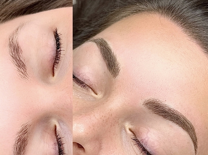 Before & After 
