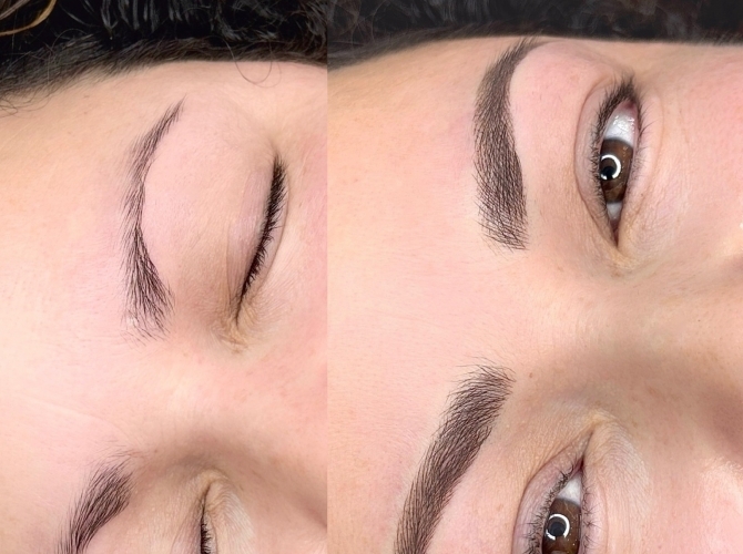 Before & After 
