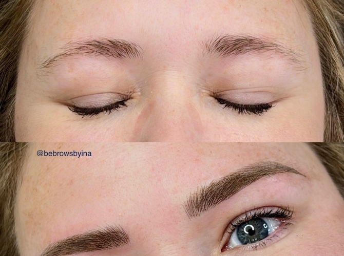 Before & After 