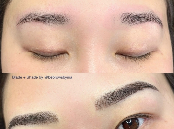 Before & After 