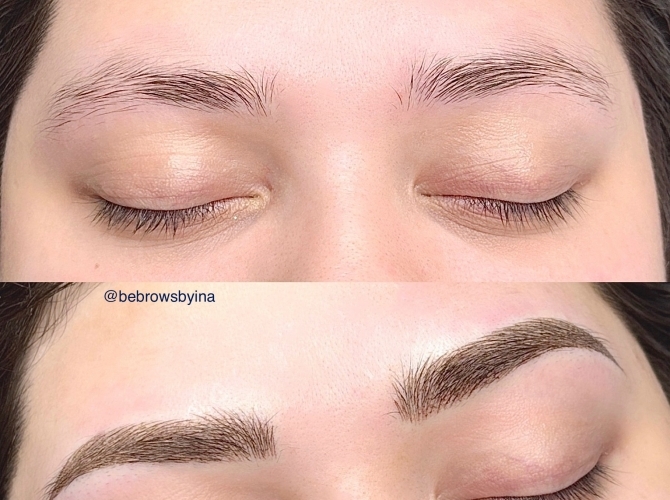 Before & After 