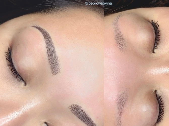 Before & After 