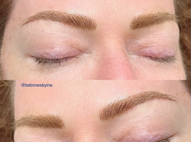 Before & After 