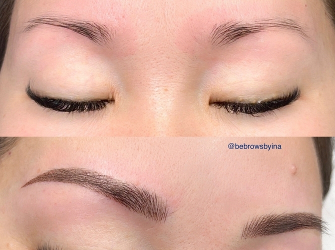 Before & After 