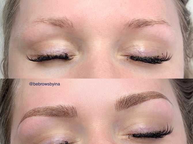 Before & After 