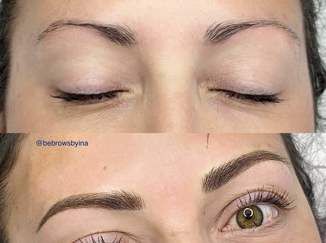 Before & After 
