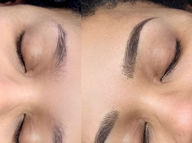 Before & After 