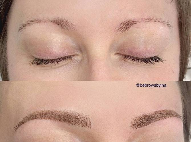 Before & After 