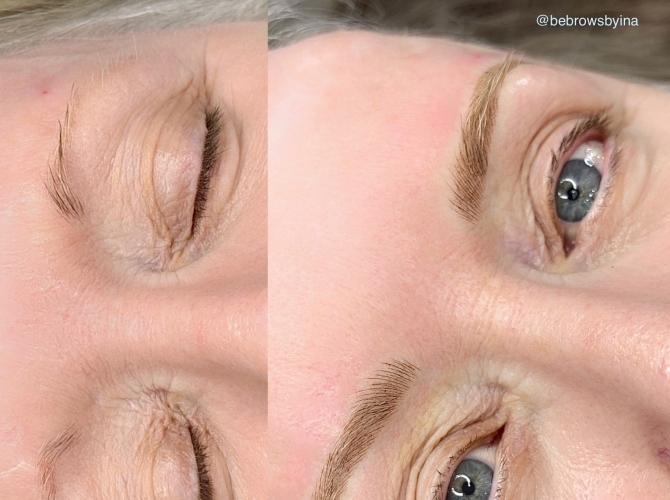 Before & After 