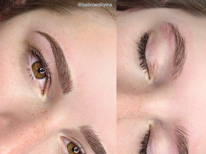 Before & After 