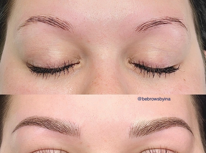 Before & After 
